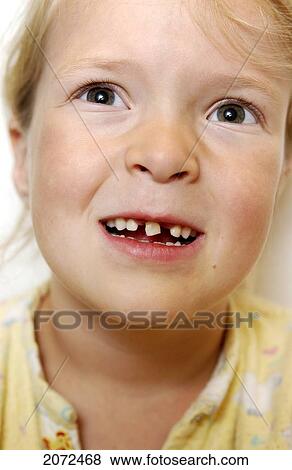 Girl With Loose Tooth View Large Photo Image Stock Photo - Girl With Loose Tooth. Fotosearch