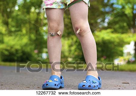 Girl with skinned knees and bandages; Picton, Ontario, Canada View Large Photo Image Stock Image - Girl with skinned knees and bandages; Picton, Ontario, Canada. Fotosearch