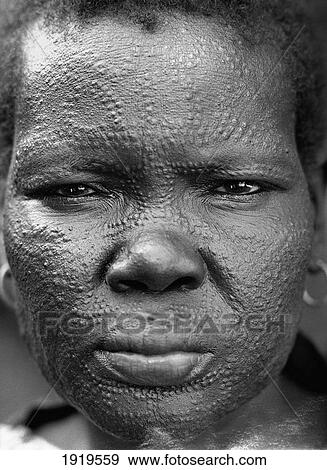 Stock Photo - Woman With Scarified Face; Lankien Village, Sudan. Fotosearch