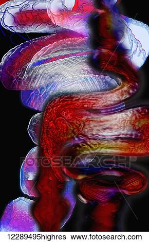 Stock Photograph - Abstract of intestines. Fotosearch