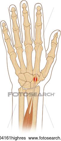 Anterior view of hand bones with inflammed extensor carpi radialis longus muscle View Large Photo Image Stock Photograph - Anterior view of hand bones with inflammed extensor carpi radialis longus muscle. Fotosearch