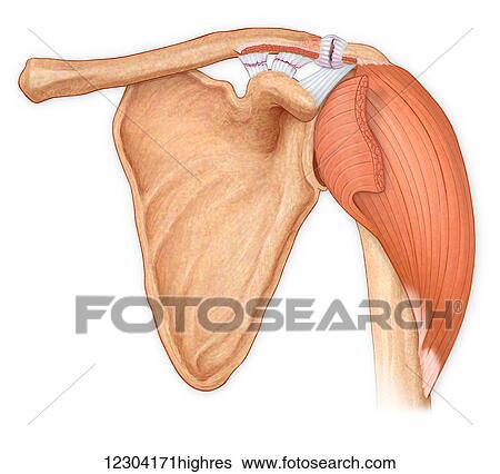 Anterior view of the shoulder joint, hilighting reflected deltoid, showing torn coracoacromial, trapezoid and conoid, acromioclavicular ligaments View Large Photo Image Stock Photograph - Anterior view of the shoulder joint, hilighting reflected deltoid, showing torn coracoacromial, trapezoid and conoid, acromioclavicular ligaments. Fotosearch