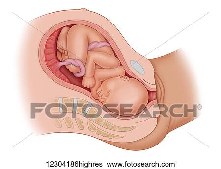 Stock Photograph - Cross section of the mothe'rs anatomy at 9 months showing the baby in uteruo LOA ready to be delivered. Fotosearch