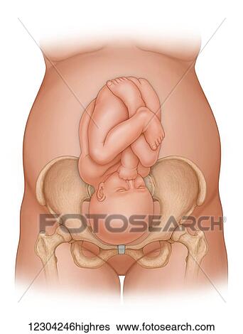 Front view of a woman nine months pregnant (baby phantomed within) ready for delivery, with baby in improper position for delivery View Large Photo Image Stock Photograph - Front view of a woman nine months pregnant (baby phantomed within) ready for delivery, with baby in improper position for delivery. Fotosearch