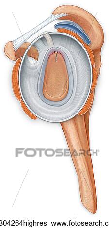 Stock Photograph - Lateral view of the shoulder joint showing the repair to the labrum. Fotosearch