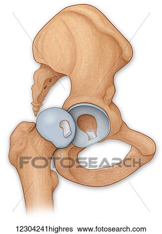 Stock Photograph - Normal anatomy of an open hip showing the articular surface of the femur and the labrum of the hip. Fotosearch