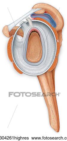 Stock Photograph - Open shoulder joint showing inflamed bursa from a bone spur and torn labrum. Fotosearch