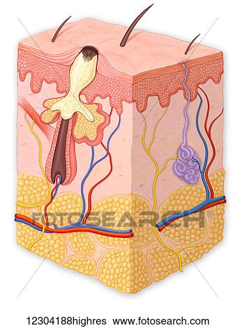 Stock Photograph - Skin cross section showing a blackhead. Fotosearch