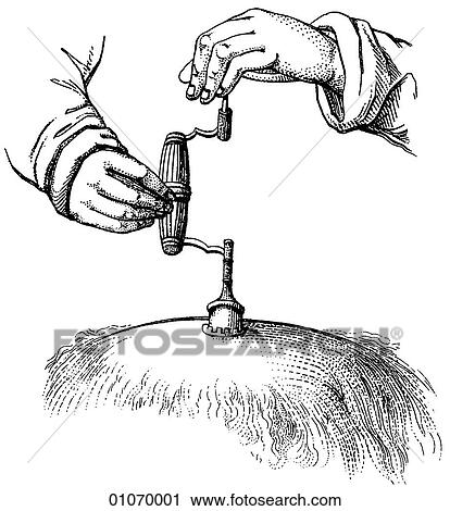 Science & Medicine - line art (Medical) An 18th century surgical illustration View Large Illustration Clip Art - Science & Medicine - line art (Medical) An 18th century surgical illustration. Fotosearch