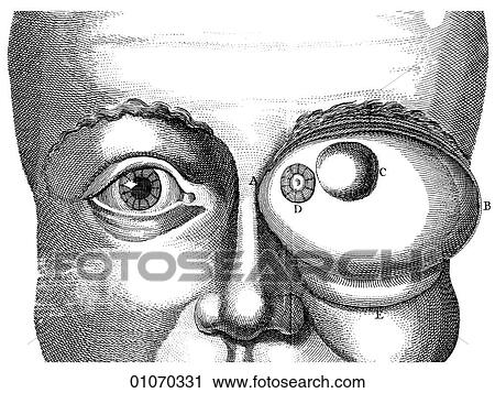 Clip Art - Science & Medicine - line art (Medical) Eye Disorder Eye Disorder Illustration from Heister`s Surgery Heister`s Surgery is an 18th century medical text published in 1743, the year Thomas Jefferson was born. It was billed as a "General system of surgery. Fotosearch