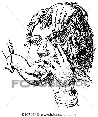 Drawing - Science & Medicine - line art (Medical) 19th century illustration. Fotosearch