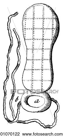 Drawing - Science & Medicine - line art (Medical) Fractures of the Bone (Devices) Illustration from Heister`s Surgery Heister`s Surgery is an 18th century medical text published in 1743, the year Thomas Jefferson was born. It was billed as a "General system of s. Fotosearch