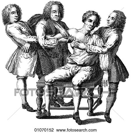 Science & Medicine - line art (Medical) Medical procedure Illustration from Heister`s Surgery Heister`s Surgery is an 18th century medical text published in 1743, the year Thomas Jefferson was born. It was billed as a "General system of surgery in thre View Large Illustration Drawing - Science & Medicine - line art (Medical) Medical procedure Illustration from Heister`s Surgery Heister`s Surgery is an 18th century medical text published in 1743, the year Thomas Jefferson was born. It was billed as a "General system of surgery in thre. Fotosearch