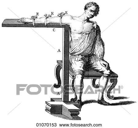 Science & Medicine - line art (Medical) Medical procedure Illustration from Heister`s Surgery Heister`s Surgery is an 18th century medical text published in 1743, the year Thomas Jefferson was born. It was billed as a "General system of surgery in thre View Large Illustration Drawing - Science & Medicine - line art (Medical) Medical procedure Illustration from Heister`s Surgery Heister`s Surgery is an 18th century medical text published in 1743, the year Thomas Jefferson was born. It was billed as a "General system of surgery in thre. Fotosearch
