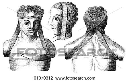 Drawing - Science & Medicine - line art (Medical) Bandages Illustration from Heister`s Surgery Heister`s Surgery is an 18th century medical text published in 1743, the year Thomas Jefferson was born. It was billed as a "General system of surgery in three parts.. Fotosearch