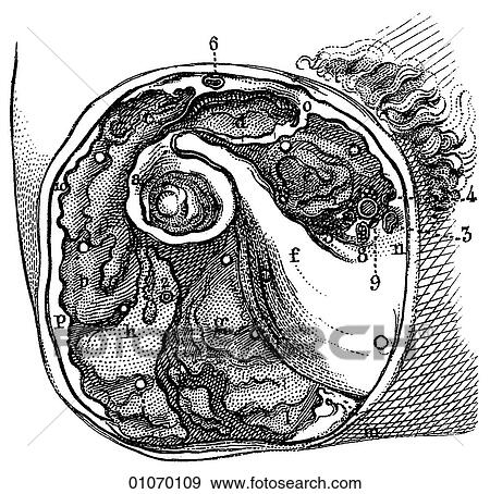 Science & Medicine - line art (Medical) 19th century surgical illustration Anatomy cross section, leg, bone, muscle, dissection View Large Illustration Stock Illustration - Science & Medicine - line art (Medical) 19th century surgical illustration Anatomy cross section, leg, bone, muscle, dissection. Fotosearch