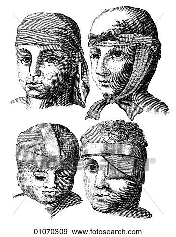 Science & Medicine - line art (Medical) Bandages Illustration from Heister`s Surgery Heister`s Surgery is an 18th century medical text published in 1743, the year Thomas Jefferson was born. It was billed as a "General system of surgery in three parts. View Large Illustration Stock Illustration - Science & Medicine - line art (Medical) Bandages Illustration from Heister`s Surgery Heister`s Surgery is an 18th century medical text published in 1743, the year Thomas Jefferson was born. It was billed as a "General system of surgery in three parts.. Fotosearch