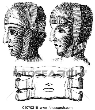 Stock Illustration - Science & Medicine - line art (Medical) Bandages Illustration from Heister`s Surgery Heister`s Surgery is an 18th century medical text published in 1743, the year Thomas Jefferson was born. It was billed as a "General system of surgery in three parts.. Fotosearch