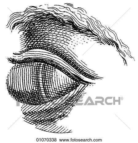 Stock Illustration - Science & Medicine - line art (Medical) Eye Disorder Illustration from Heister`s Surgery Heister`s Surgery is an 18th century medical text published in 1743, the year Thomas Jefferson was born. It was billed as a "General system of surgery in three par. Fotosearch