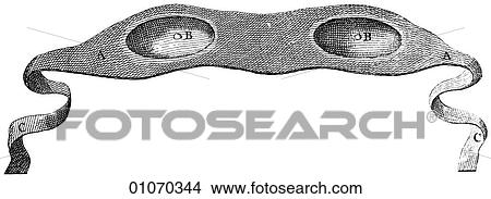 Stock Illustration - Science & Medicine - line art (Medical) Eye Disorders and Instruments Medical Device Illustration from Heister`s Surgery Heister`s Surgery is an 18th century medical text published in 1743, the year Thomas Jefferson was born. It was billed as a "Genera. Fotosearch