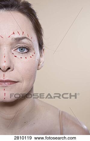 Markings on woman's face before plastic surgery View Large Photo Image Stock Photo - Markings on woman's face before plastic surgery . Fotosearch