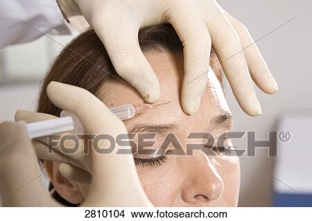 Picture - Surgeon injecting into forehead of patient . Fotosearch