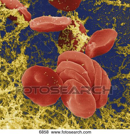 Stock Photo - Close-up of red blood cells . Fotosearch