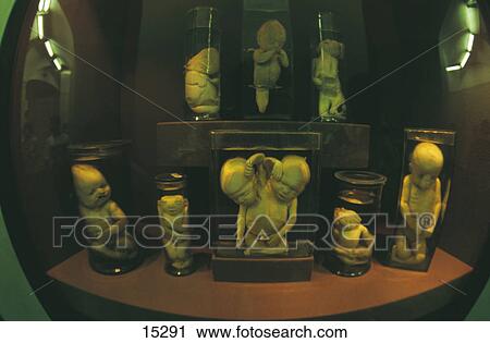 Stock Image - Foetus in museum, Kunstkammer Museum, St. Petersburg, Russia, Europe . Fotosearch