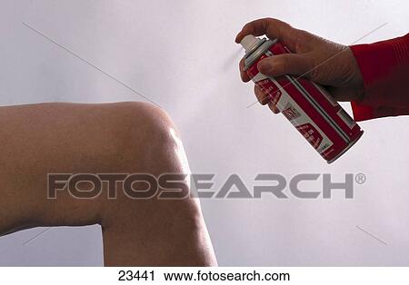 Stock Image - Close-up of person's hand spraying knee of another person . Fotosearch