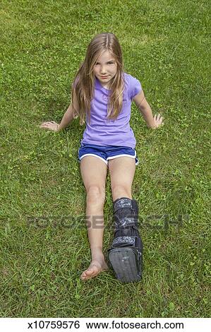 preteen-girl-with-a-broken-leg-stock-ima