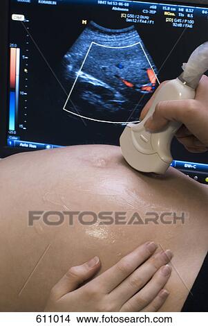 A woman having an ultrasound scan View Large Photo Image Picture - A woman having an ultrasound scan. Fotosearch