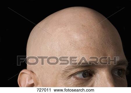 Stock Image - Bald head of a man. Fotosearch