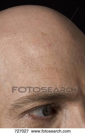 Stock Photo - Bald head of a man. Fotosearch
