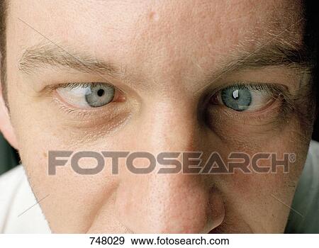 Close-up of a man with eyes crossed View Large Photo Image Stock Photo - Close-up of a man with eyes crossed. Fotosearch