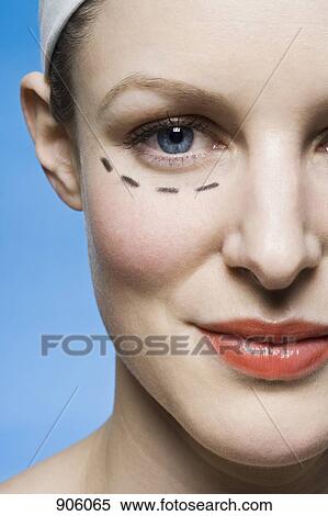 A woman with a plastic surgery guide drawn under her eye View Large Photo Image Stock Photography - A woman with a plastic surgery guide drawn under her eye. Fotosearch