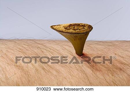 Thorn in the flesh View Large Photo Image Stock Image - Thorn in the flesh. Fotosearch