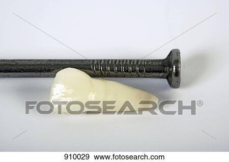 Tooth and nail View Large Photo Image Stock Photo - Tooth and nail. Fotosearch