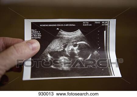 Ultrasound of a human fetus View Large Photo Image Stock Image - Ultrasound of a human fetus. Fotosearch
