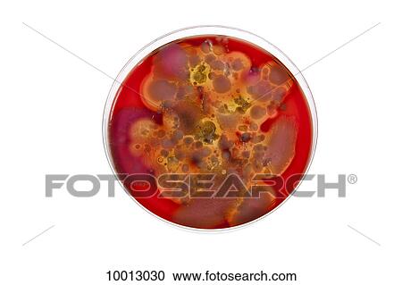 A bacteria culture growing in a Petri dish View Large Photo Image Stock Image - A bacteria culture growing in a Petri dish. Fotosearch