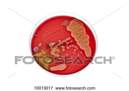 Stock Photo - A bacteria culture growing in a Petri dish. Fotosearch