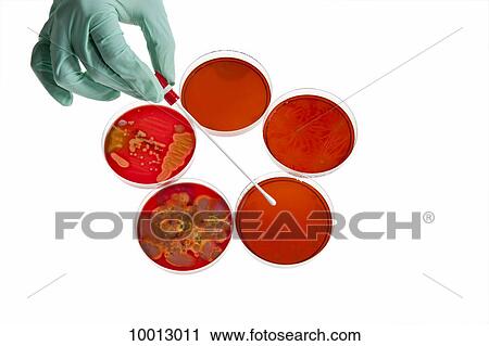 A lab technician using a cotton swab on a Petri dish with a bacteria culture, close-up of hand View Large Photo Image Stock Image - A lab technician using a cotton swab on a Petri dish with a bacteria culture, close-up of hand. Fotosearch