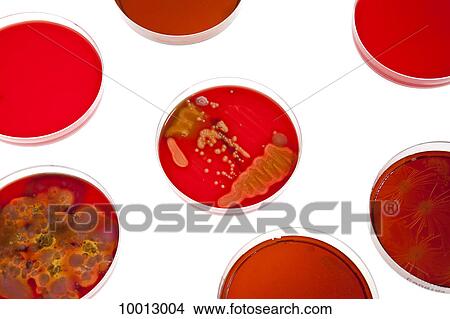 Picture - Petri dishes holding different stages of bacteria cultures. Fotosearch