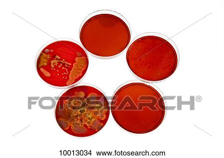 Picture - Petri dishes holding different stages of bacteria cultures. Fotosearch