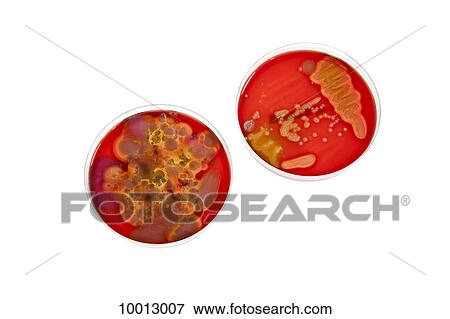 Stock Photo - Petri dishes holding different stages of bacteria cultures. Fotosearch