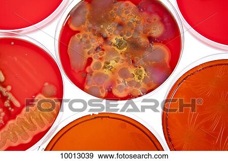 Stock Photo - Petri dishes holding different stages of bacteria cultures. Fotosearch