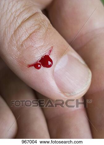 Blood seeping from a thumb View Large Photo Image Picture - Blood seeping from a thumb. Fotosearch