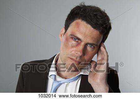 A beaten up businessman touching his temple View Large Photo Image Picture - A beaten up businessman touching his temple. Fotosearch
