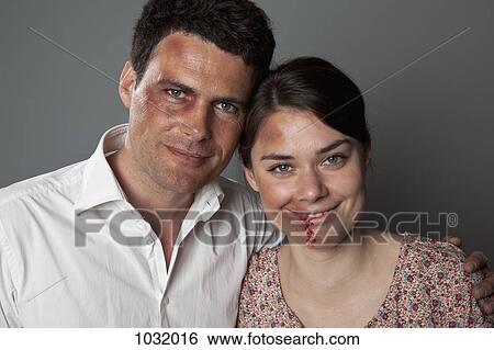A bruised and beaten couple smiling cheerfully at the camera View Large Photo Image Stock Photograph - A bruised and beaten couple smiling cheerfully at the camera. Fotosearch