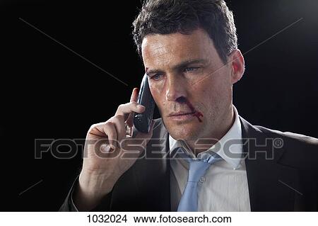 Picture - A businessman with bruises and a bloody nose using his mobile. Fotosearch