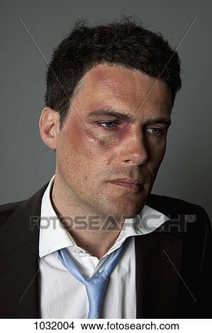 A defeated businessman with bruises View Large Photo Image Picture - A defeated businessman with bruises. Fotosearch